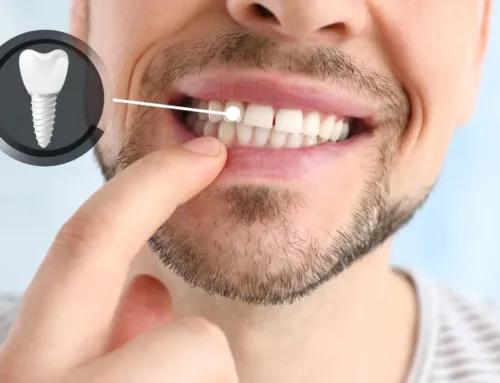 Is a “Stress-Smile” Wrecking Your Teeth? Why Your Morning Headache Might Be a Dental Issue